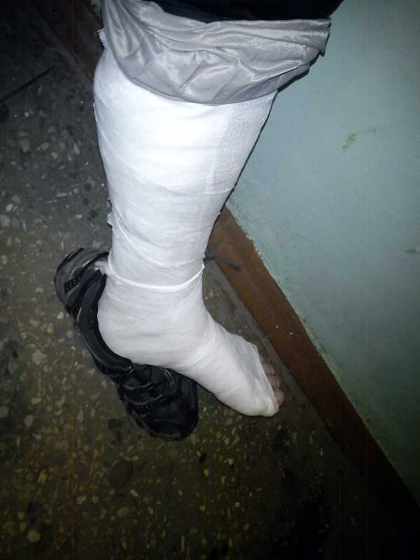 my_leg_after_morning_run.jpg